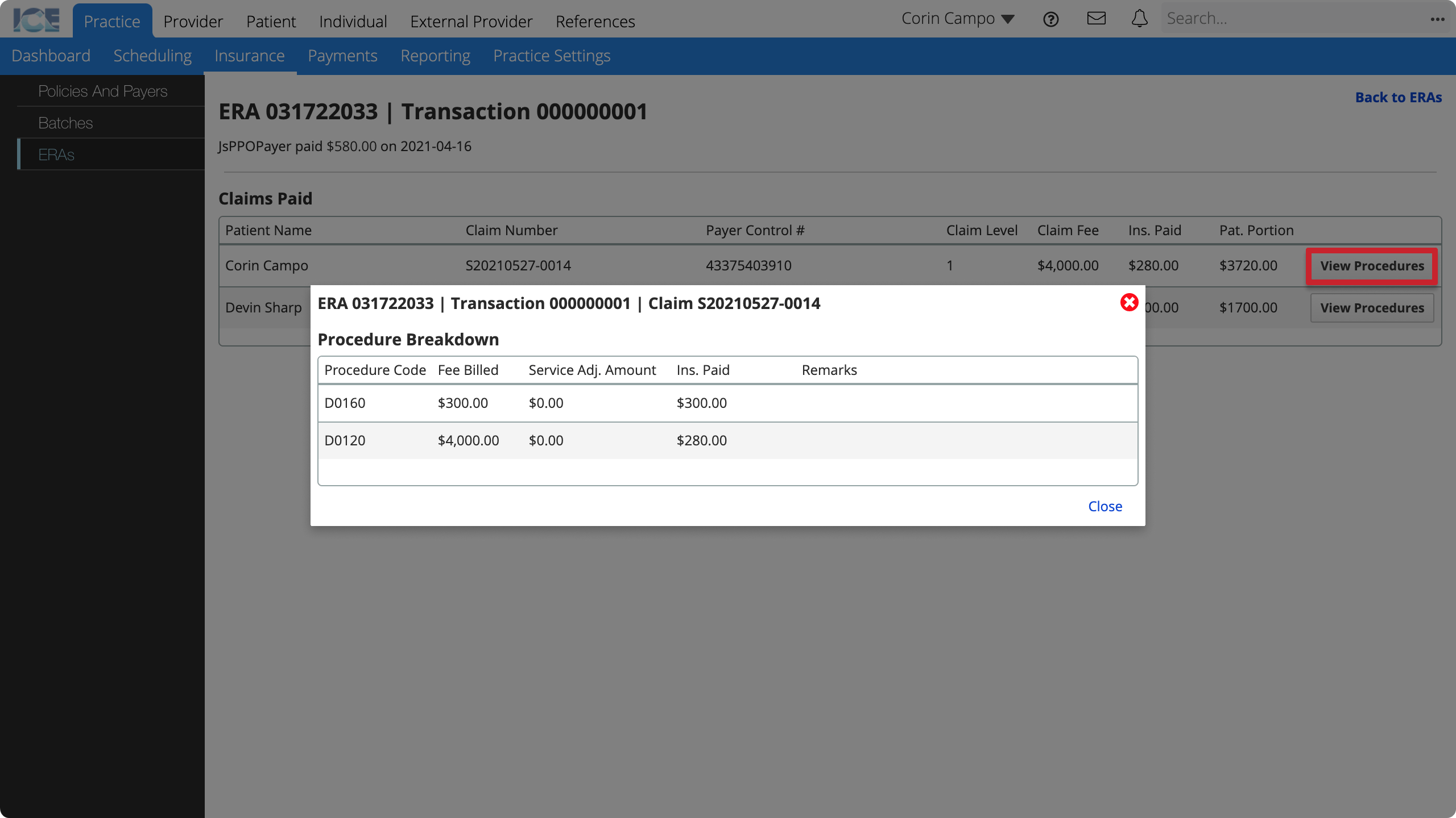 The View Procedures button is at the far right of the table for each claim line. The Procedure Breakdown dialog opens to show amounts for each code and any remarks.